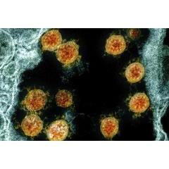 Microscopic image of Covid-19 virus 